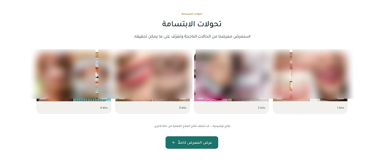Smile transformations gallery